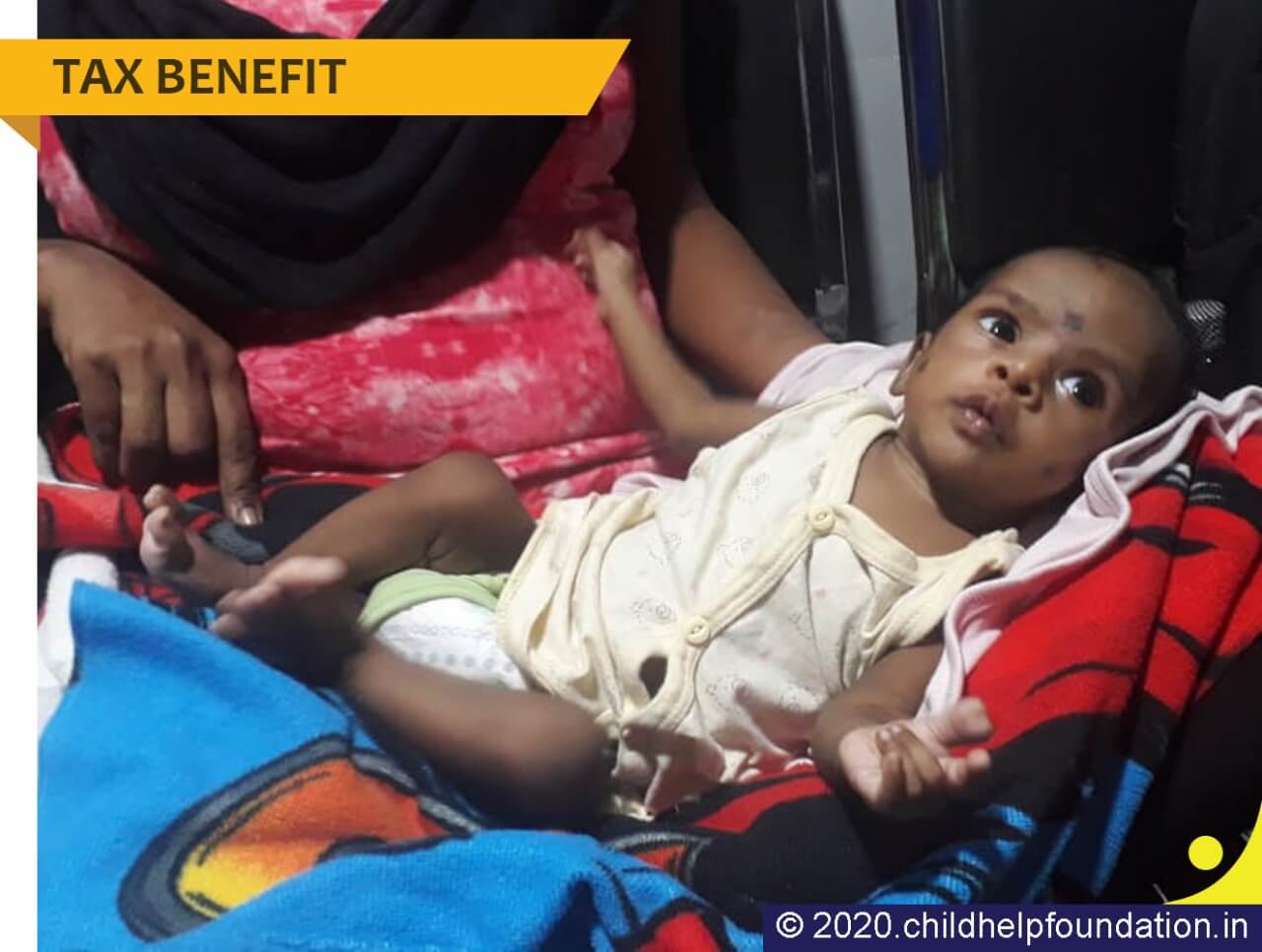 Baby Vikash heart valve has got a blockage and he needs to operate it